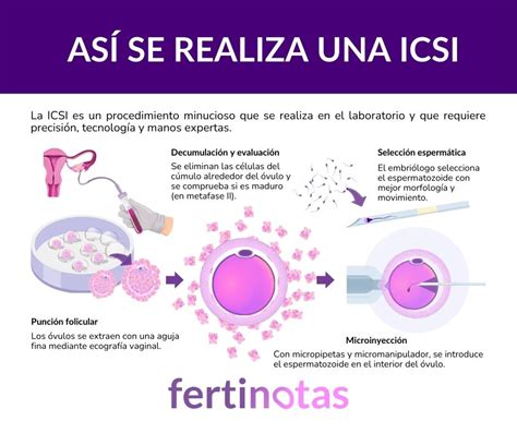 Infografía: Indicaciones de la ICSI