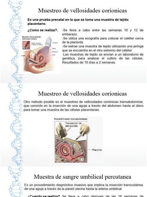 Infografía mostrando los dos métodos de toma de muestra de vellosidades coriónicas