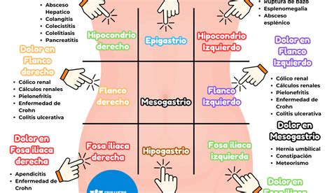 Esquema del abdomen con la localización típica del dolor de apendicitis y su posible desplazamiento durante el embarazo.