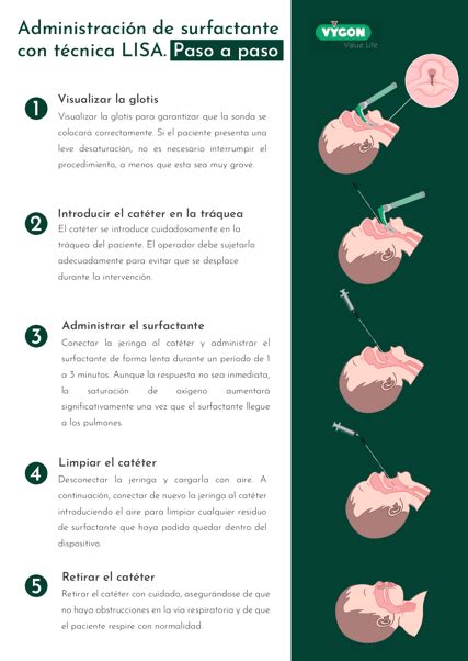 Ilustración de la aplicación de surfactante a un recién nacido