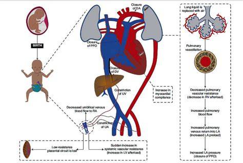 Esquema sobre la importancia de la NP en neonatos: interrupción del cordón umbilical, necesidades nutricionales y soporte metabólico vital.