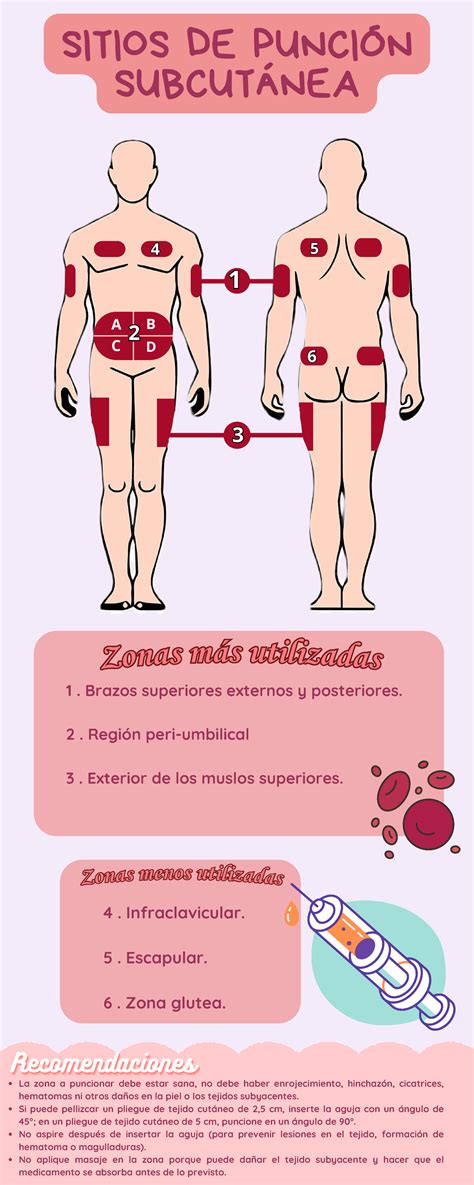 Diagrama mostrando la zona segura de punción en el talón de un recién nacido