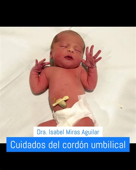Foto de un recién nacido con el cordón umbilical