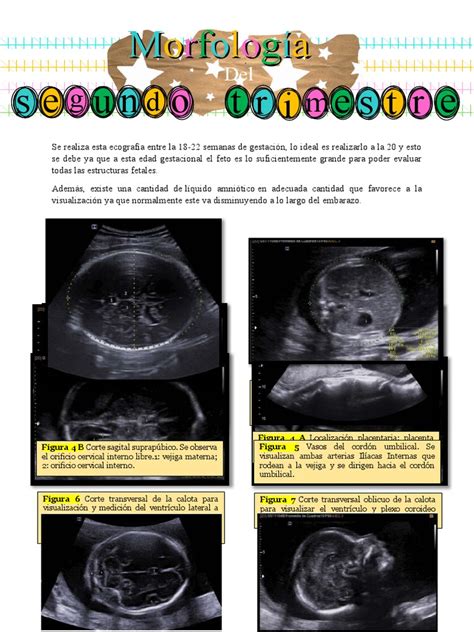 Esquema de las estructuras fetales visibles en ecografía