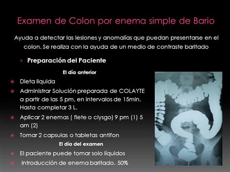 Esquema del procedimiento de enema baritado en un adulto