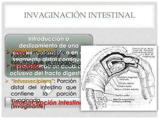 Diagrama explicando la invaginación intestinal
