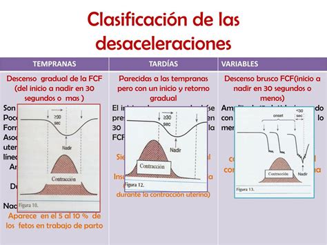 Gráfico mostrando FCF basal, aceleraciones y diferentes tipos de dips