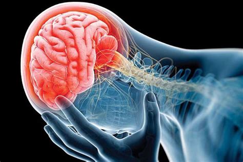 Diagrama: Consecuencias neurológicas del dolor repetido en prematuros