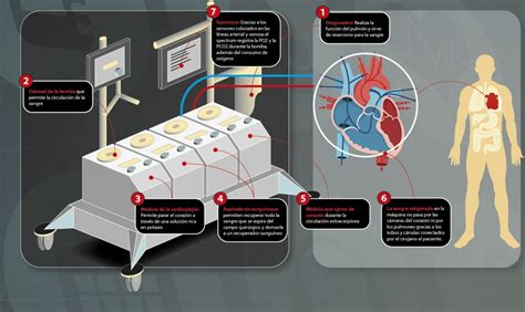Diagrama de funcionamiento de la máquina de circulación extracorpórea