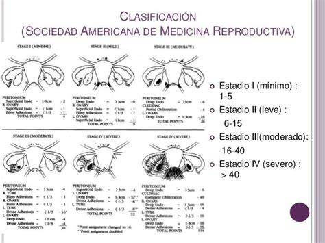 Tabla resumen de los grados de endometriosis según la clasificación de la American Fertility Society (AFS/rASRM)