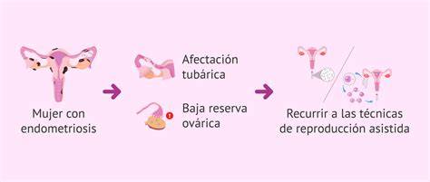 Representación esquemática de la afectación de la endometriosis en la fertilidad femenina
