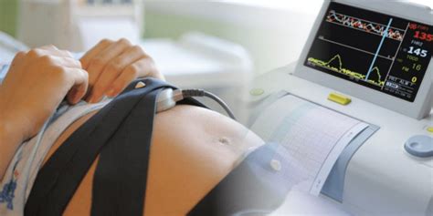 Imagen de una ecografía fetal o monitorización cardiotocográfica