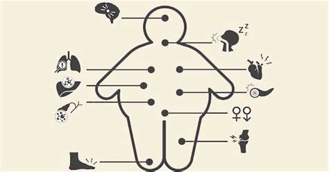 Esquema de las complicaciones de la obesidad en la salud reproductiva femenina