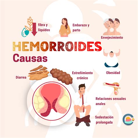 infografía sobre las causas de las hemorroides postparto: presión uterina, esfuerzo del parto, hormonas, estreñimiento, sedentarismo