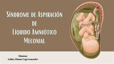 Imagen de meconio en líquido amniótico