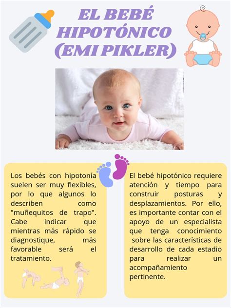 Ilustración comparativa de la postura de un bebé hipotónico (