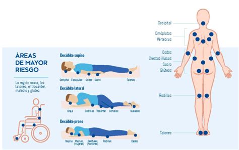 Infografía detallando las áreas del cuerpo más propensas a la hiperpigmentación durante el embarazo, como pezones, axilas, abdomen y rostro.