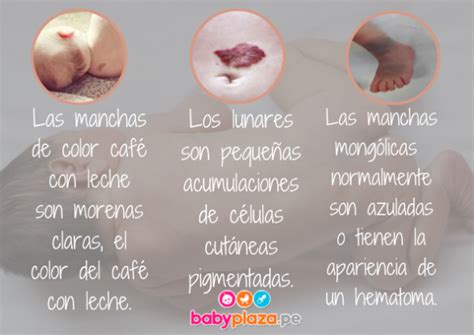 Infografía comparativa de diferentes tipos de marcas de nacimiento comunes en bebés, mostrando su apariencia y ubicación.