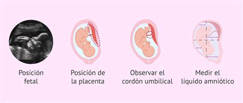 Esquema de cómo funciona una ecografía fetal