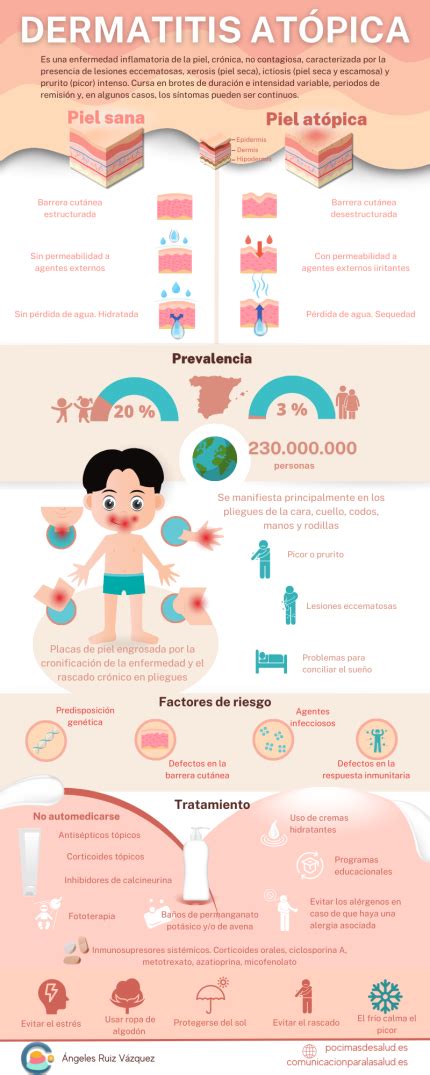 Infografía comparativa de la dermatitis seborreica infantil y la dermatitis atópica.
