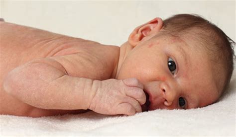 Ilustración de la piel de un recién nacido con unto sebáceo y lanugo