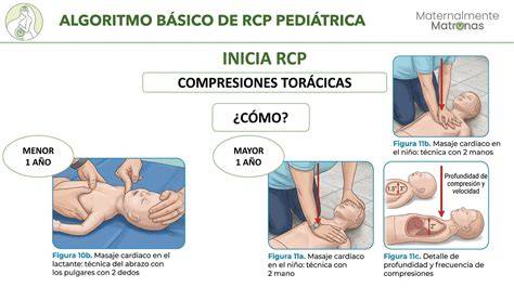 Esquema de golpes interescapulares y compresiones torácicas para lactantes, según ERC 2025