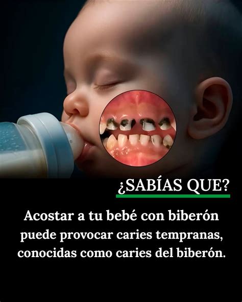Infografía: Mecanismo de formación de caries del biberón