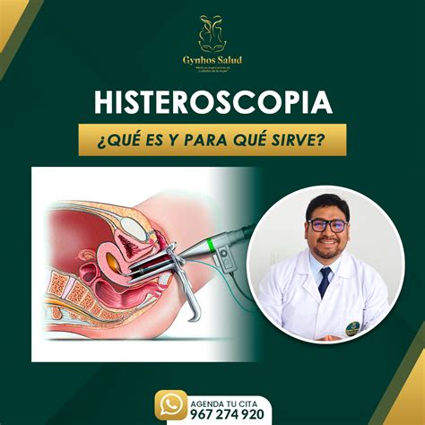 ilustración detallada del histeroscopio y su inserción en el útero