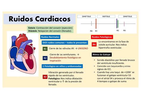 Fonocardiograma ilustrando la temporalidad y relación de los ruidos cardíacos R1, R2, R3 y R4