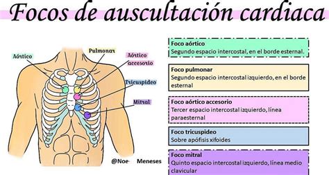 Diagrama anatómico de los focos de auscultación cardíaca en el tórax pediátrico (aórtico, pulmonar, tricúspide, mitral, accesorio de Erb)