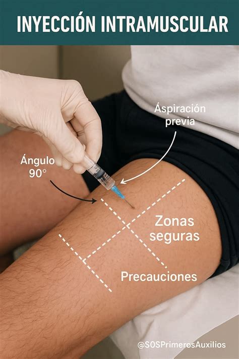 Diagrama de puntos de inyección intramuscular recomendados para la IGHB y la vacuna
