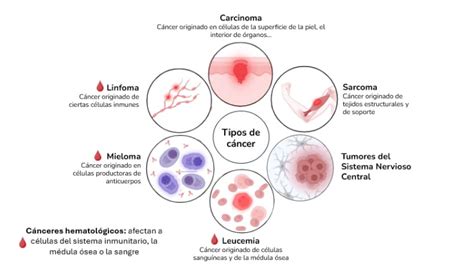 Representación gráfica de los tipos de cáncer infantil más comunes en España, destacando la leucemia, tumores del sistema nervioso central y linfomas.