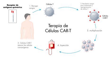 Diagrama explicativo de la inmunoterapia con células CAR-T, mostrando el proceso de extracción, modificación y reintroducción de los linfocitos T.