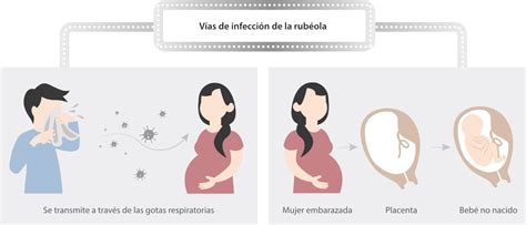 Esquema de las vías de transmisión materno-fetal de infecciones