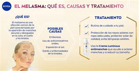 infografía sobre las causas y zonas comunes de aparición del melasma en el embarazo
