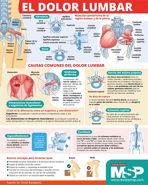Infografía mostrando puntos de presión comunes para el alivio del dolor lumbar en embarazadas