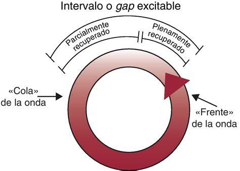 Diagrama de un circuito de reentrada en la aurícula