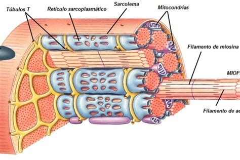 Esquema de las fibras musculares y el efecto de la distrofia