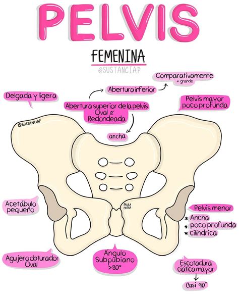 Esquema de la anatomía pélvica femenina con implantes de endometriosis