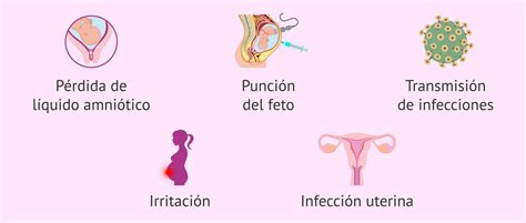 Gráfico de porcentajes de riesgos asociados a la amniocentesis.