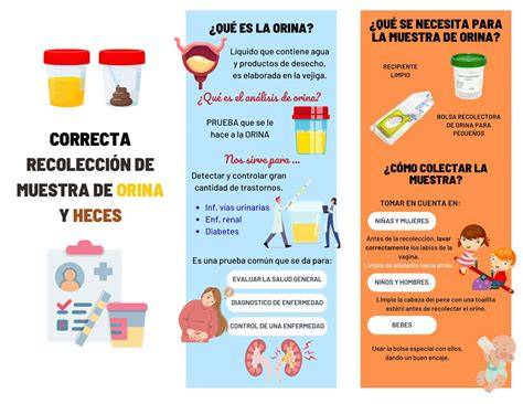 Infografía paso a paso para la recogida de muestras de orina en pacientes pediátricos durante la prueba de concentración renal.