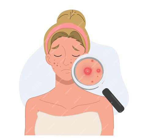 ilustración de piel con acné comparada con piel limpia