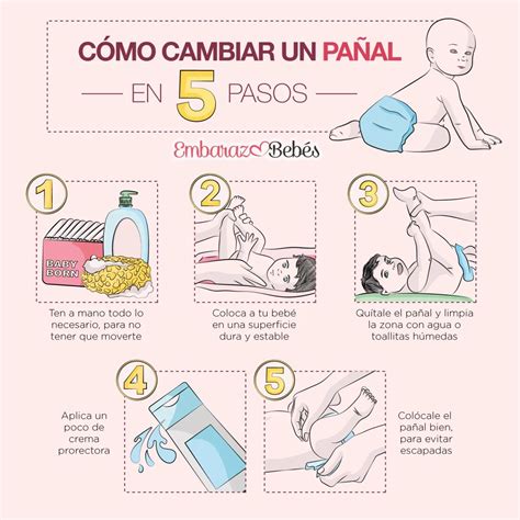 Esquema de cómo colocar un pañal a un bebé prematuro