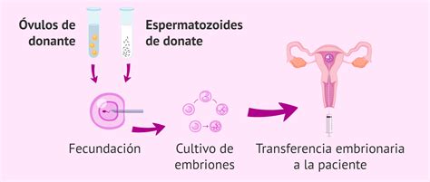 Infografía general del proceso de FIV con donación de gametos