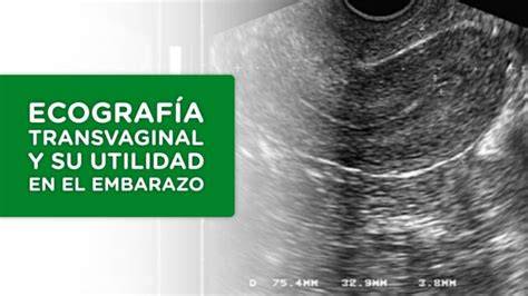 Ecografía transvaginal mostrando un embarazo temprano.