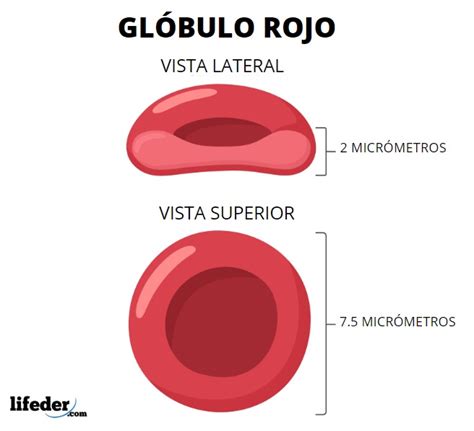 Esquema que muestra la relación entre el tamaño de los glóbulos rojos (VCM) y los diferentes tipos de anemia, comparando glóbulos normales con microcitos y macrocitos.