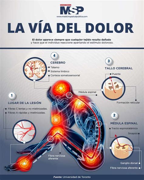 infografía sobre alivio del dolor natural en embarazo