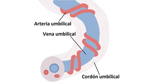 Esquema anatómico que muestra el trayecto de las estructuras umbilicales (vena, arterias y uraco) en el neonato.