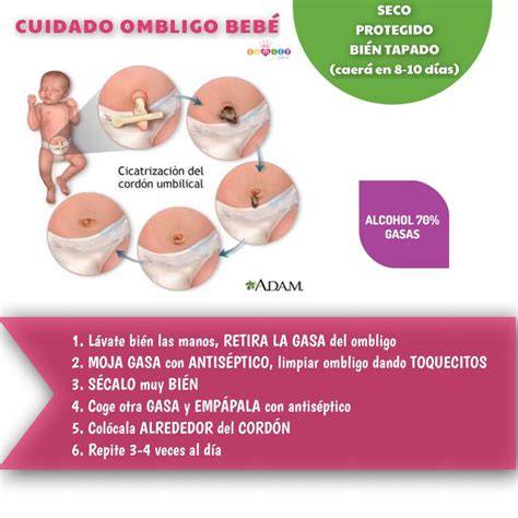 Infografía: Pasos para el cuidado del ombligo del bebé