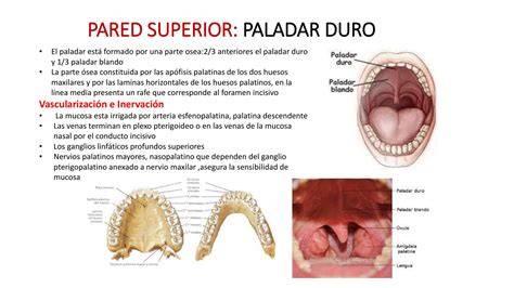 Esquema anatómico comparativo de un paladar normal frente a uno con fisura palatina